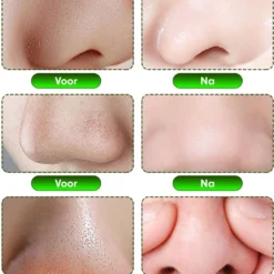 Aichun Beauty The Dead Sea Mud Peel Off Mask - Tegen Mee-Eters En Verstopte Poriën - Acne - Natuurlijk Product - 120ML 17 Aichun Beauty The Dead Sea Mud Peel Off Mask - Tegen Mee-Eters En Verstopte Poriën - Acne - Natuurlijk Product - 120ML -Goedkope Gezicht Zoet Winkel 1051x1200 1