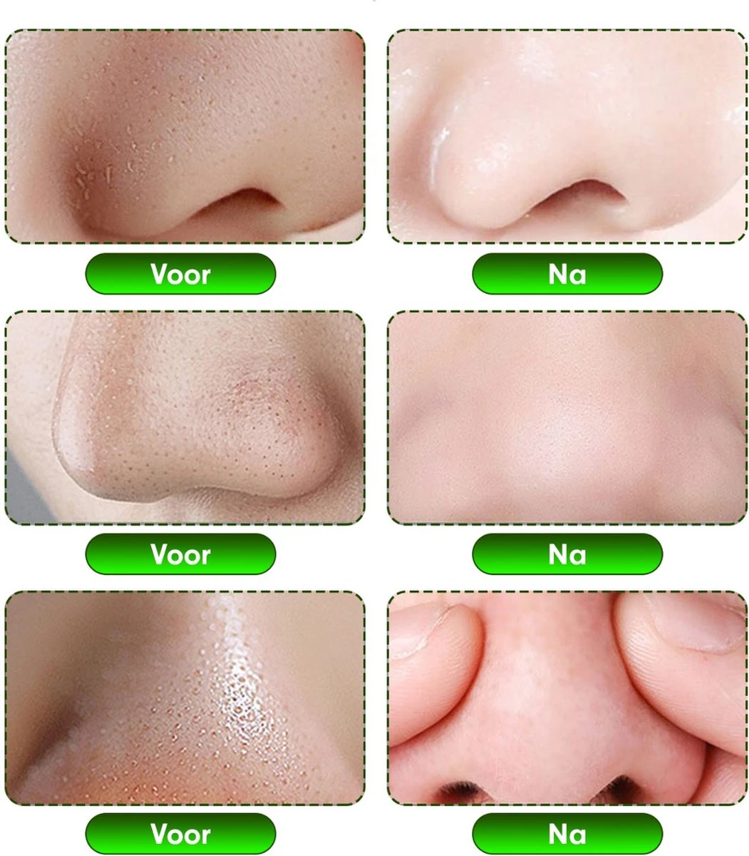 Aichun Beauty The Dead Sea Mud Peel Off Mask - Tegen Mee-Eters En Verstopte Poriën - Acne - Natuurlijk Product - 120ML 7 Aichun Beauty The Dead Sea Mud Peel Off Mask - Tegen Mee-Eters En Verstopte Poriën - Acne - Natuurlijk Product - 120ML - Afbeelding 7