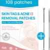 Acne Patches (108x) Met Blackhead Remover Set - Puisten Pleister - Puisten Verwijderaar - 108 Pleisters In 2 Formaten - Mee Eters Verwijderen - Pimple Patch Voor Acneverzorging Met Comedonenlepel Set - Acne Stickers