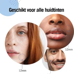 Kascin Puisten Patch Met Hydrocolloide - Acne Pleisters, Pimple Patch - Made In Korea, 39 Stuks, Pleister In Twee Maten: Diameter Van 24 X 12 Mm En 15 X 10 Mm | Puistjes Pleisters 13 Kascin Puisten Patch Met Hydrocolloide - Acne Pleisters, Pimple Patch - Made In Korea, 39 Stuks, Pleister In Twee Maten: Diameter Van 24 X 12 Mm En 15 X 10 Mm | Puistjes Pleisters -Goedkope Gezicht Zoet Winkel 1140x1200 2