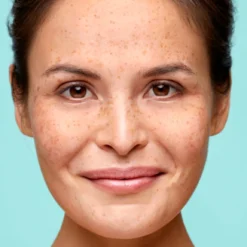 Biodermal Couperose Dagcrème - Voorkomt Zichtbaarheid Rosacea - 30ml -Goedkope Gezicht Zoet Winkel 1154x1200 2