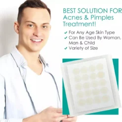 Pimple Patches - Acne Patches - Pimple Patch - Puisten Pleisters - Acne Pleister - 108 Stuks -Goedkope Gezicht Zoet Winkel 1170x1200 2