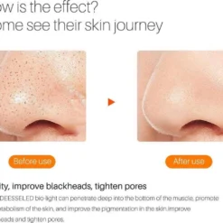 JTEX® - Professioneel LED Masker - Gezichtsmasker - Face Mask - Lichttherapie - 7 Soorten Behandelingen - Anti Rimpel - Anti Acne Huidverzorging - Skin Cleaner - Masker - Anti Aging Mask - Gezichtsbehandeling - New Generation - LED Masker -Goedkope Gezicht Zoet Winkel 1200x1035