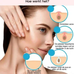 Acne Patches (108x) Met Blackhead Remover Set - Puisten Pleister - Puisten Verwijderaar - 108 Pleisters In 2 Formaten - Mee Eters Verwijderen - Pimple Patch Voor Acneverzorging Met Comedonenlepel Set - Acne Stickers -Goedkope Gezicht Zoet Winkel 1200x1158 2