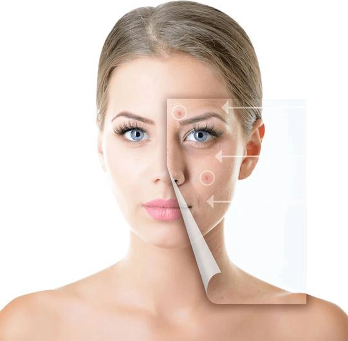 Comedonenlepel | Blackhead | Mee-eters Verwijderen 2 Comedonenlepel | Blackhead | Mee-eters Verwijderen - Afbeelding 2