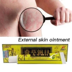 Psoriasis/exzeem Chineese Creme 14 Psoriasis/exzeem Chineese Creme -Goedkope Gezicht Zoet Winkel 1200x1200 31