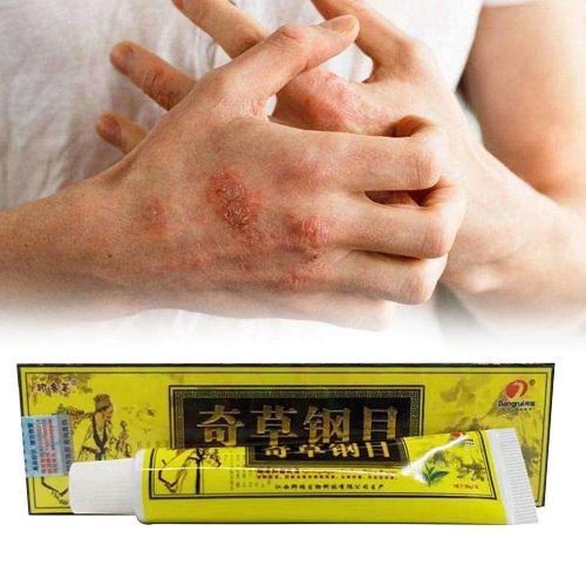 Psoriasis/exzeem Chineese Creme 6 Psoriasis/exzeem Chineese Creme - Afbeelding 6