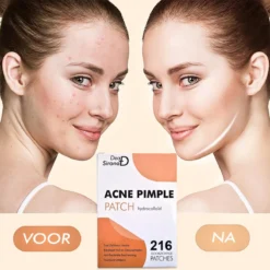 Dea Sirona Pimple Patch - Acne Patch - Puisten Verwijderaar - Puisten Pleister - Acne Pleister - Acne Sticker - Puistjes Verwijderen - 216 Stuks 15 Dea Sirona Pimple Patch - Acne Patch - Puisten Verwijderaar - Puisten Pleister - Acne Pleister - Acne Sticker - Puistjes Verwijderen - 216 Stuks -Goedkope Gezicht Zoet Winkel 1200x1200 422