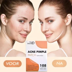 Dea Sirona Pimple Patch - Acne Patch - Puisten Verwijderaar - Puisten Pleister - Acne Pleister - Acne Sticker - Puistjes Verwijderen - 108 Stuks 16 Dea Sirona Pimple Patch - Acne Patch - Puisten Verwijderaar - Puisten Pleister - Acne Pleister - Acne Sticker - Puistjes Verwijderen - 108 Stuks -Goedkope Gezicht Zoet Winkel 1200x1200 531