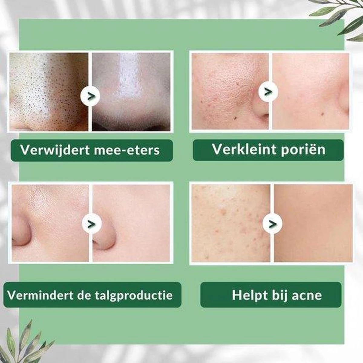 MENGSIQI - Green Mask Stick - Huidverzorging - Gezichtsmasker - Kleimasker - Mee Eters & Acne Verwijderen - Acne Verzorging - Vette Huid - Mee-eter Verwijderaar - Poriën Reiniger -Blackhead - Unisex - Verzachtend -Verkoelend - Dermatologisch Getest 15 MENGSIQI - Green Mask Stick - Huidverzorging - Gezichtsmasker - Kleimasker - Mee Eters & Acne Verwijderen - Acne Verzorging - Vette Huid - Mee-eter Verwijderaar - Poriën Reiniger -Blackhead - Unisex - Verzachtend -Verkoelend - Dermatologisch Getest - Afbeelding 15