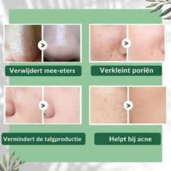 MENGSIQI - Green Mask Stick - Huidverzorging - Gezichtsmasker - Kleimasker - Mee Eters & Acne Verwijderen - Acne Verzorging - Vette Huid - Mee-eter Verwijderaar - Poriën Reiniger -Blackhead - Unisex - Verzachtend -Verkoelend - Dermatologisch Getest 31 MENGSIQI - Green Mask Stick - Huidverzorging - Gezichtsmasker - Kleimasker - Mee Eters & Acne Verwijderen - Acne Verzorging - Vette Huid - Mee-eter Verwijderaar - Poriën Reiniger -Blackhead - Unisex - Verzachtend -Verkoelend - Dermatologisch Getest -Goedkope Gezicht Zoet Winkel 1200x1200 803