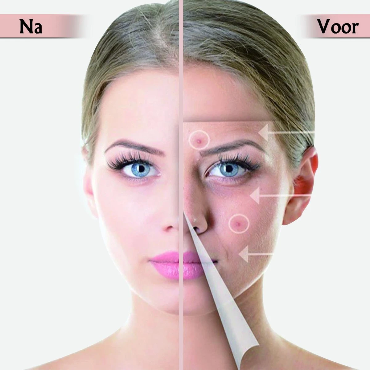 Acne Patches Voor Dag En Nacht - Puisten Verwijderaar - Huidreiniger - 144 Stuks In 2 Formaten - Pukkel Pleister - Pimple Patch Die Onzuiverheden Absorbeert - Acneverzorging 6 Acne Patches Voor Dag En Nacht - Puisten Verwijderaar - Huidreiniger - 144 Stuks In 2 Formaten - Pukkel Pleister - Pimple Patch Die Onzuiverheden Absorbeert - Acneverzorging - Afbeelding 6