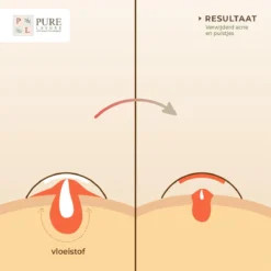 Pimple Patch 144 ST - Acne Patch - Acne - Acne Pleister - Pimple Patches - Puisten Verwijderaar 15 Pimple Patch 144 ST - Acne Patch - Acne - Acne Pleister - Pimple Patches - Puisten Verwijderaar -Goedkope Gezicht Zoet Winkel 1200x1200 836