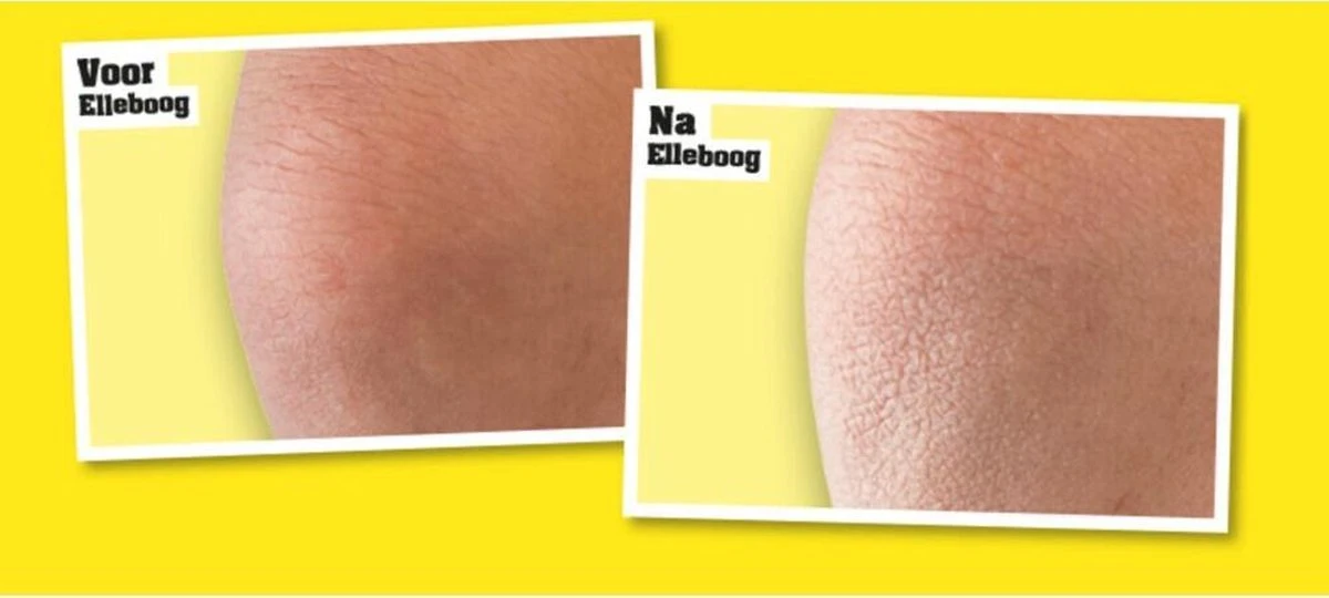 O'Keeffe's Bodylotion Skin Repair 325 Ml 5 O'Keeffe's Bodylotion Skin Repair 325 Ml - Afbeelding 5