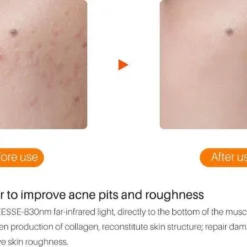 JTEX® - Professioneel LED Masker - Gezichtsmasker - Face Mask - Lichttherapie - 7 Soorten Behandelingen - Anti Rimpel - Anti Acne Huidverzorging - Skin Cleaner - Masker - Anti Aging Mask - Gezichtsbehandeling - New Generation - LED Masker -Goedkope Gezicht Zoet Winkel 1200x808 1