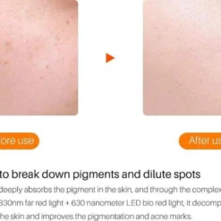 JTEX® - Professioneel LED Masker - Gezichtsmasker - Face Mask - Lichttherapie - 7 Soorten Behandelingen - Anti Rimpel - Anti Acne Huidverzorging - Skin Cleaner - Masker - Anti Aging Mask - Gezichtsbehandeling - New Generation - LED Masker -Goedkope Gezicht Zoet Winkel 1200x808