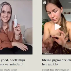 Skinlight Huidbleekcreme - 60ml - Alle Huidtypes - Maakt De Huid Tot 3 Tinten Lichter 10 Skinlight Huidbleekcreme - 60ml - Alle Huidtypes - Maakt De Huid Tot 3 Tinten Lichter -Goedkope Gezicht Zoet Winkel 1200x955