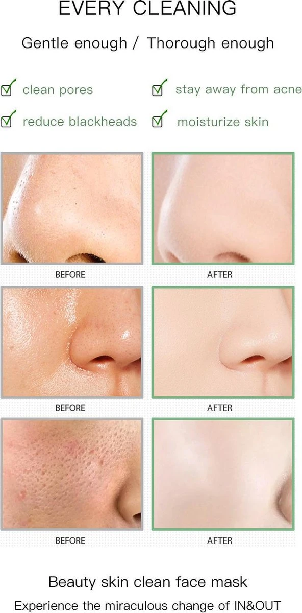 Merkloos Green Mask Stick - Huidverzorging - Gezichtsmasker - Kleimasker - Mee Eters & Acne Verwijderen - Acne Verzorging - Vette Huid - Mee-eter Verwijderaar - Poriën Reiniger -Blackhead - Verzachtend -Verkoelend - Dermatologisch Getest 3 Merkloos Green Mask Stick - Huidverzorging - Gezichtsmasker - Kleimasker - Mee Eters & Acne Verwijderen - Acne Verzorging - Vette Huid - Mee-eter Verwijderaar - Poriën Reiniger -Blackhead - Verzachtend -Verkoelend - Dermatologisch Getest - Afbeelding 3