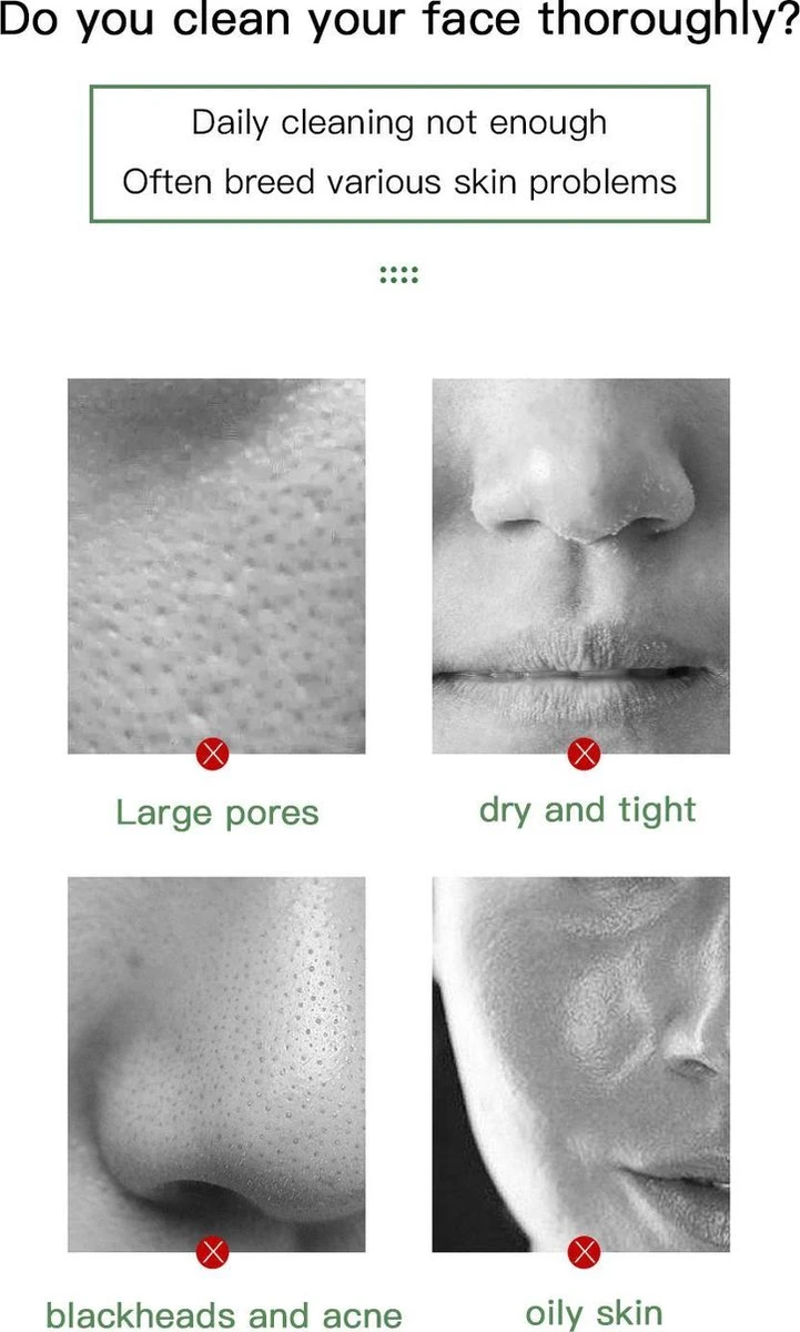 Merkloos Green Mask Stick - Huidverzorging - Gezichtsmasker - Kleimasker - Mee Eters & Acne Verwijderen - Acne Verzorging - Vette Huid - Mee-eter Verwijderaar - Poriën Reiniger -Blackhead - Verzachtend -Verkoelend - Dermatologisch Getest 4 Merkloos Green Mask Stick - Huidverzorging - Gezichtsmasker - Kleimasker - Mee Eters & Acne Verwijderen - Acne Verzorging - Vette Huid - Mee-eter Verwijderaar - Poriën Reiniger -Blackhead - Verzachtend -Verkoelend - Dermatologisch Getest - Afbeelding 4