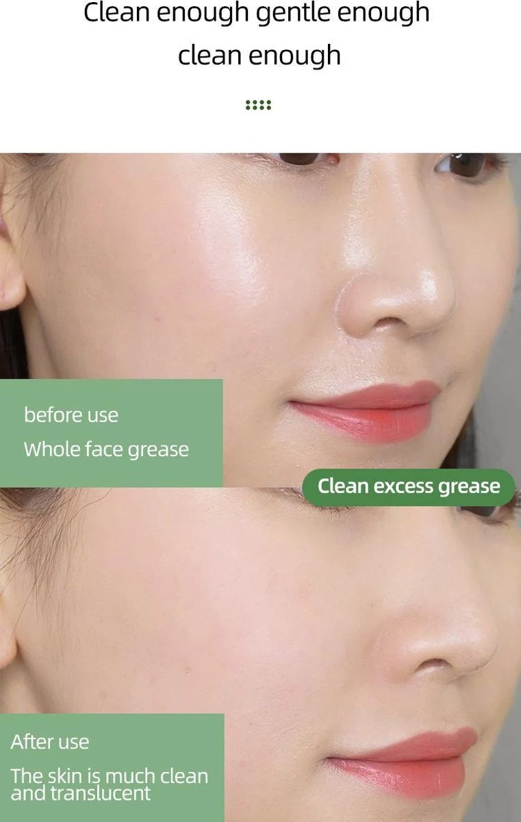 MENGSIQI - Green Mask Stick - Huidverzorging - Gezichtsmasker - Kleimasker - Mee Eters & Acne Verwijderen - Acne Verzorging - Vette Huid - Mee-eter Verwijderaar - Poriën Reiniger -Blackhead - Unisex - Verzachtend -Verkoelend - Dermatologisch Getest 6 MENGSIQI - Green Mask Stick - Huidverzorging - Gezichtsmasker - Kleimasker - Mee Eters & Acne Verwijderen - Acne Verzorging - Vette Huid - Mee-eter Verwijderaar - Poriën Reiniger -Blackhead - Unisex - Verzachtend -Verkoelend - Dermatologisch Getest - Afbeelding 6