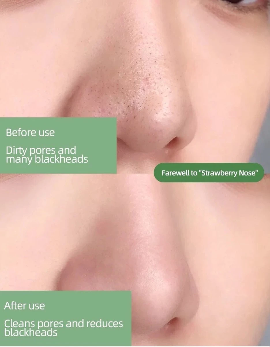 Sidas Mask PAQIMAN - Green Mask Stick - Gezichtsmasker - Mee Eters Verwijderen - Blackhead Remover - Verkoelend - Hydraterend - Kleimasker- Klei Masker - Verzachtend - Groene Thee - Huidverzorging - Maskers 6 Sidas Mask PAQIMAN - Green Mask Stick - Gezichtsmasker - Mee Eters Verwijderen - Blackhead Remover - Verkoelend - Hydraterend - Kleimasker- Klei Masker - Verzachtend - Groene Thee - Huidverzorging - Maskers - Afbeelding 6