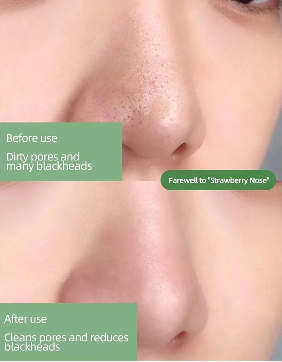 MENGSIQI - Green Mask Stick - Huidverzorging - Gezichtsmasker - Kleimasker - Mee Eters & Acne Verwijderen - Acne Verzorging - Vette Huid - Mee-eter Verwijderaar - Poriën Reiniger -Blackhead - Unisex - Verzachtend -Verkoelend - Dermatologisch Getest 8 MENGSIQI - Green Mask Stick - Huidverzorging - Gezichtsmasker - Kleimasker - Mee Eters & Acne Verwijderen - Acne Verzorging - Vette Huid - Mee-eter Verwijderaar - Poriën Reiniger -Blackhead - Unisex - Verzachtend -Verkoelend - Dermatologisch Getest - Afbeelding 8